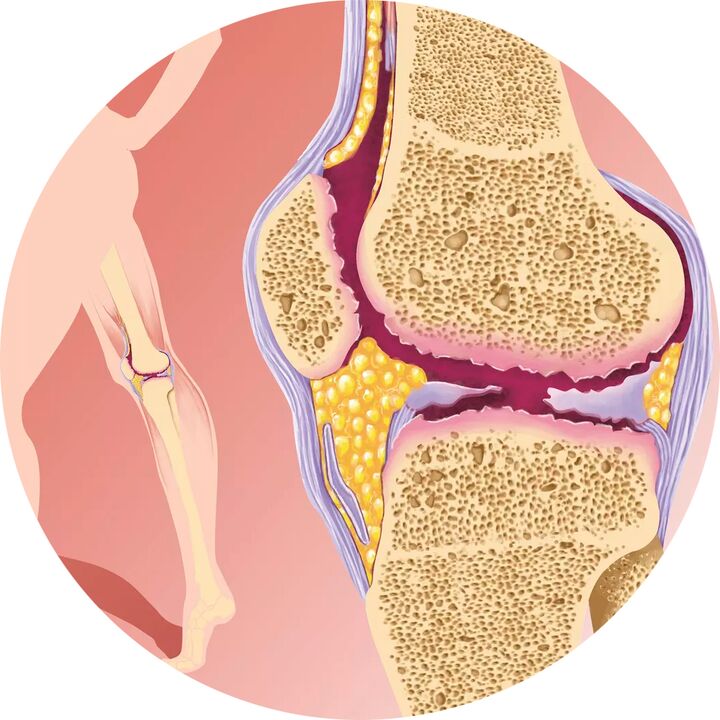 Hondroten - Ondersteunt de gewrichtsmobiliteit