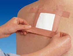 Een therapeutische pleister gebruiken voor rugpijn